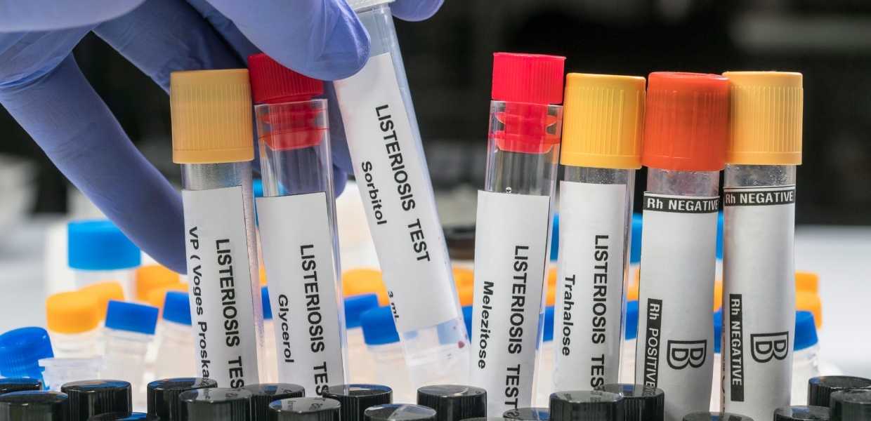Diagnostican personas con listeriosis por consumir helado de la marca Blue Bell